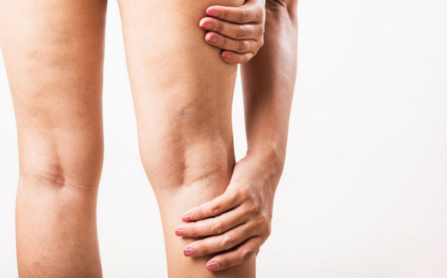 Как уменьшить дискомфорт в суставах при активном образе жизни